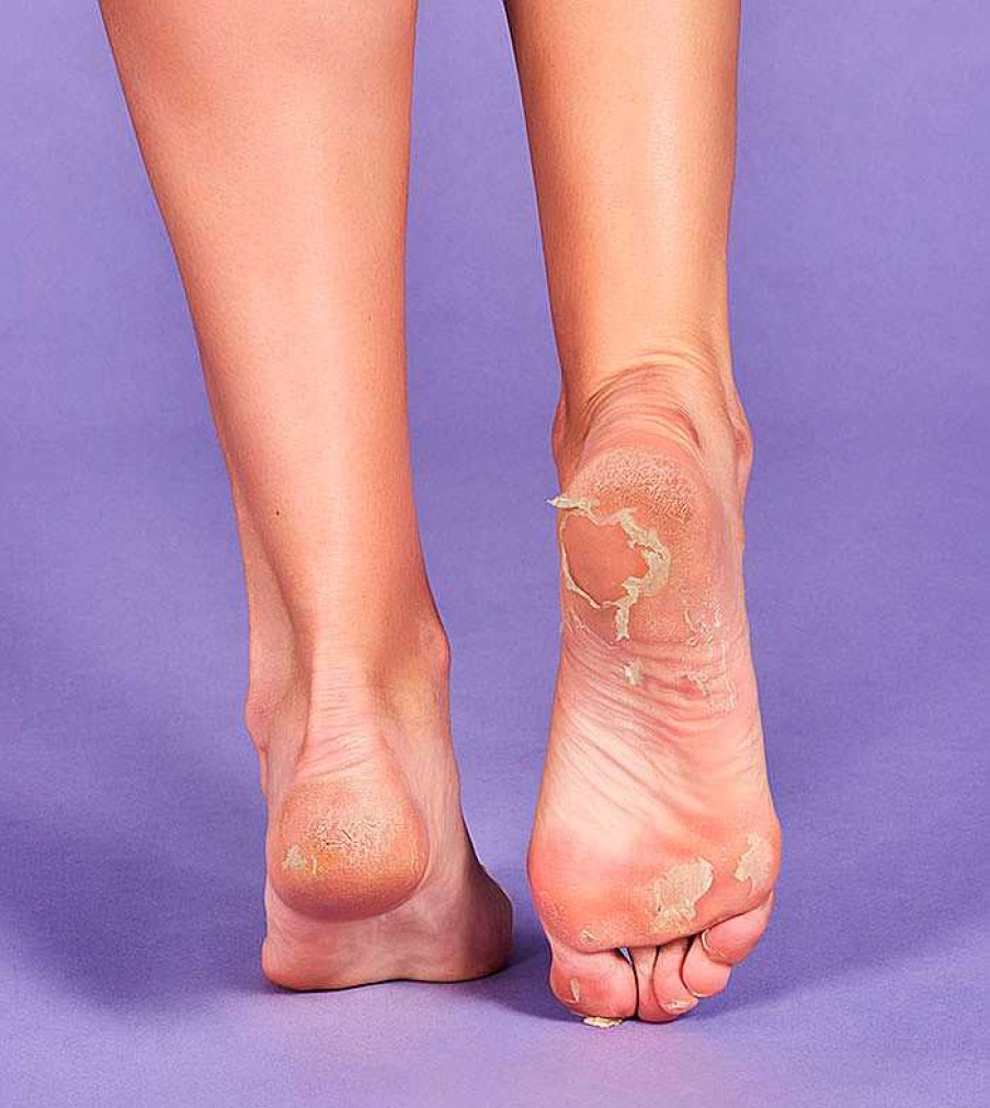 Cuidado De Los Pies | Iroha Nature Iroha Nature - Calcetines Mascarilla Exfoliantes Para Pies - Lavanda